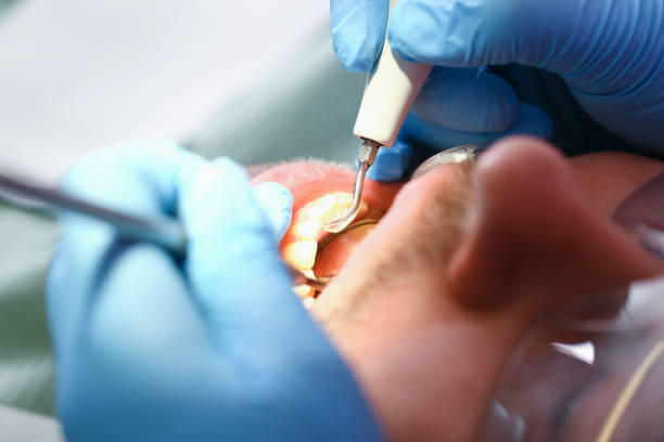 Best Emergency Denture Repair in Red Bluff, CA