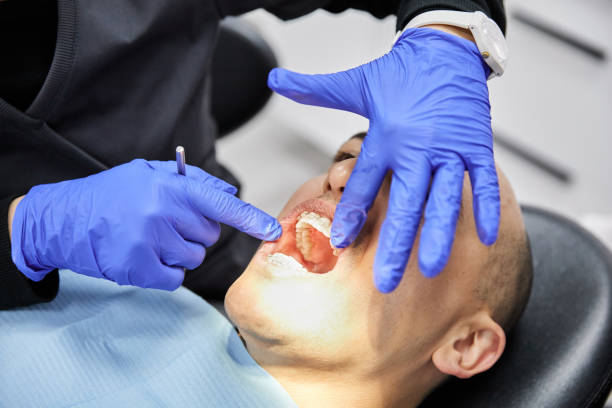 Best Knocked-Out Tooth (Avulsed Tooth) Treatment in Red Bluff, CA